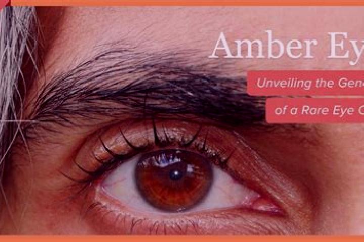 Abigail, 32, a black amber-eyed mixed companion based in Olching. Offering GFE, Roleplay, Overnight. Available for incall and outcall, day and evening dates.