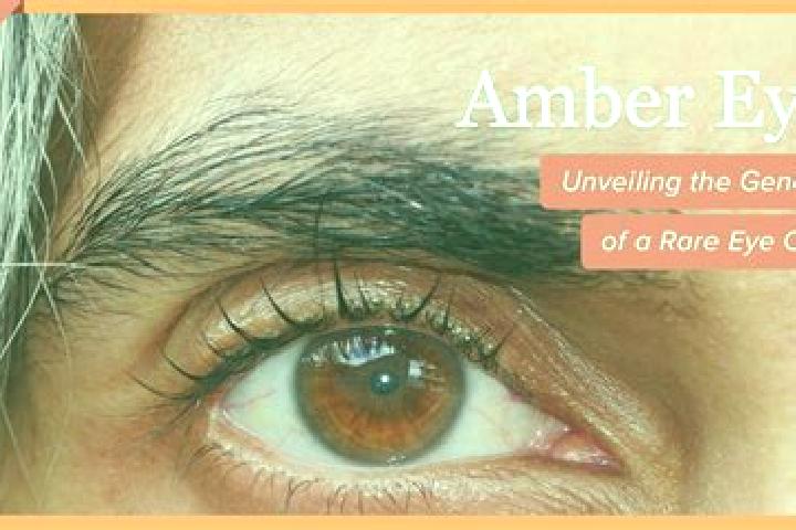 Abigail, 37, a red amber-eyed mixed companion based in Bouee. Offering Striptease, 69, Couples. Available for incall and outcall, day and evening dates.