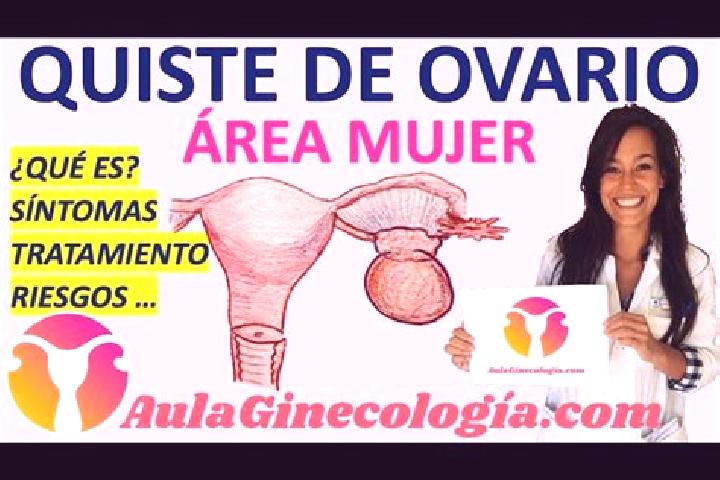Aria, 39 — Escort in Hoyos de Miguel Munoz, Spain