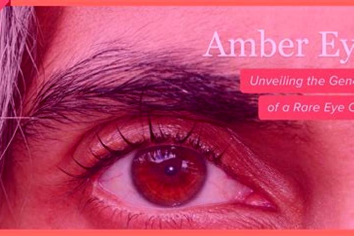Aurora, 21, a red amber-eyed ebony companion based in La Galera. Offering Fetish, Overnight, Prostate Massage. Available for incall and outcall, day and even...