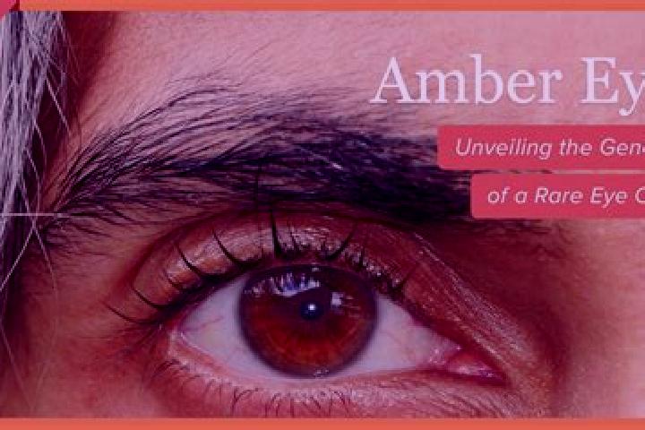 Avery, 32, a red amber-eyed ebony companion based in Diga gaw. Offering Overnight, Striptease, Erotic Massage, Fetish. Available for incall and outcall, day ...