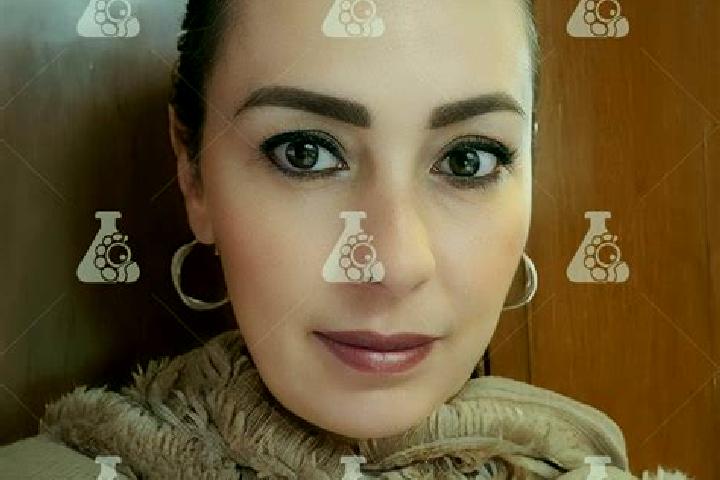 Ella, 38 — Escort in Nueva Villa de Padilla, Mexico