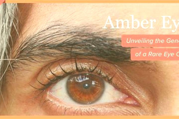 Emma, 21, a red amber-eyed ebony companion based in Bekegem. Offering Striptease, Domination, Couples. Available for incall and outcall, day and evening dates.