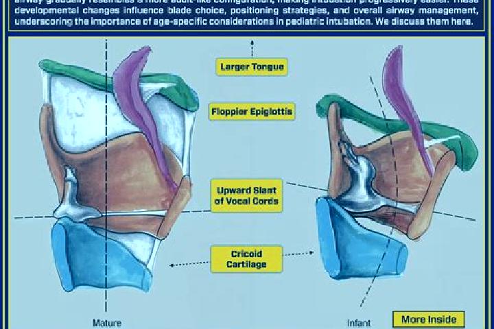 escort Airway Heights