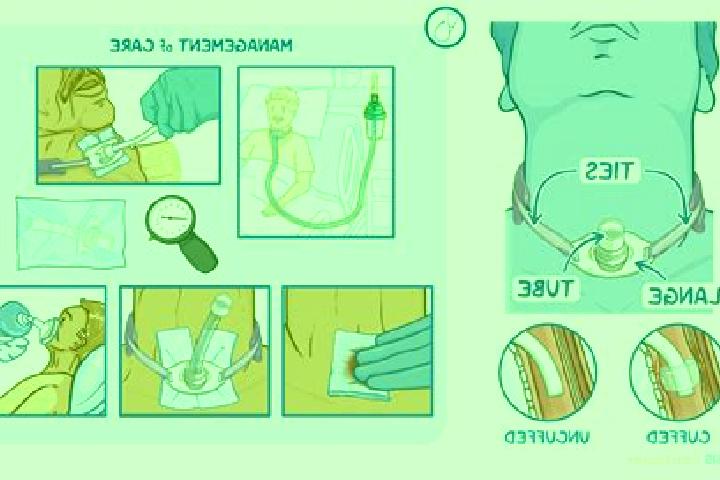 escort An Trach