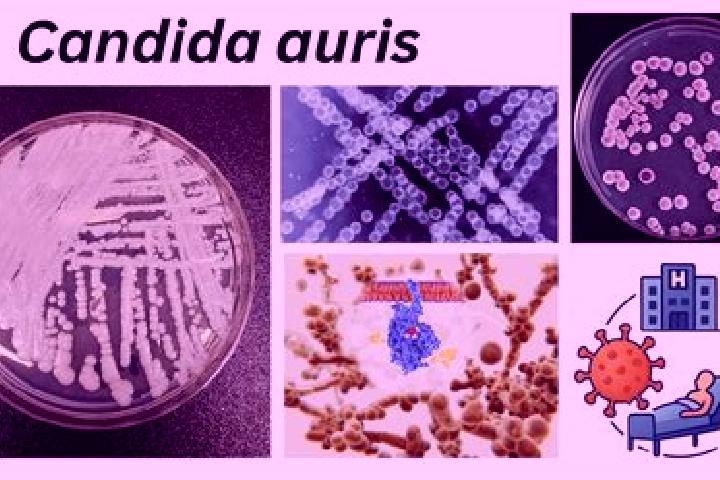 escort Candida