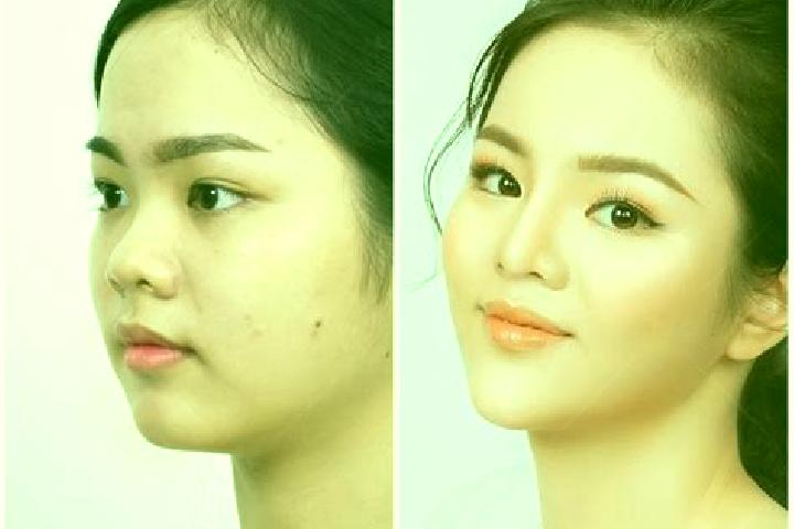 escort Canh Nang