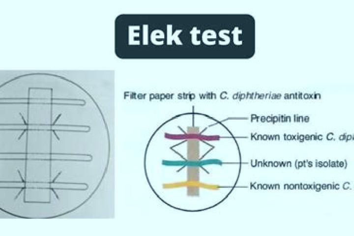 escort Elek