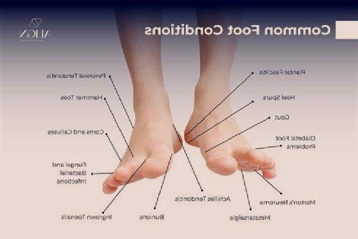 escort Foot of Ten