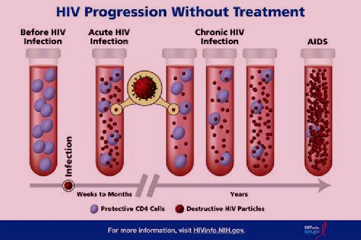 escort Hiv