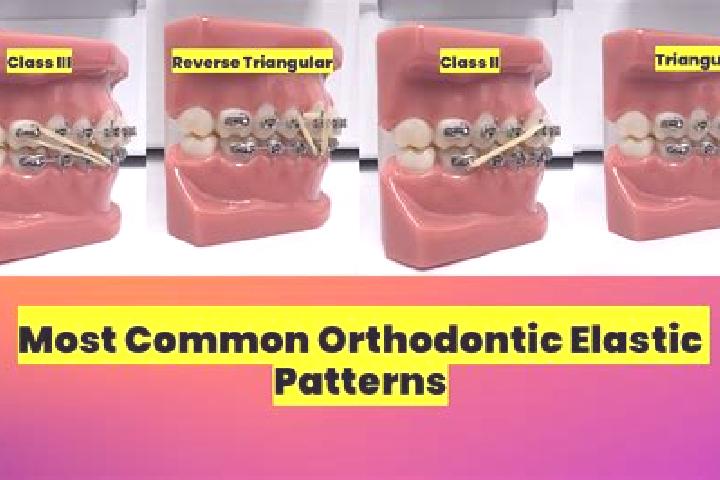 escort Ortho