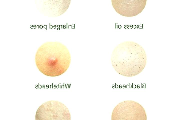 escort Pore