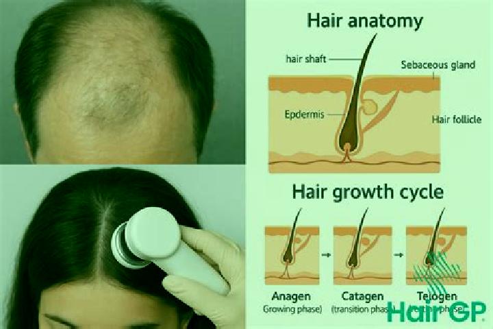 escort Scalp Level