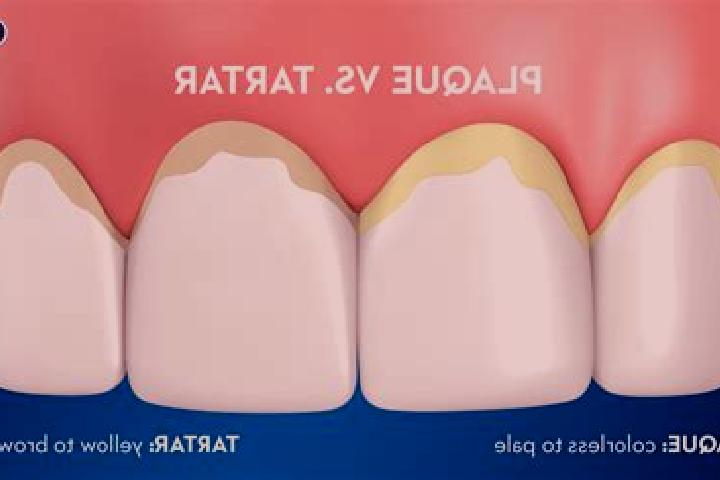 escort Tartar