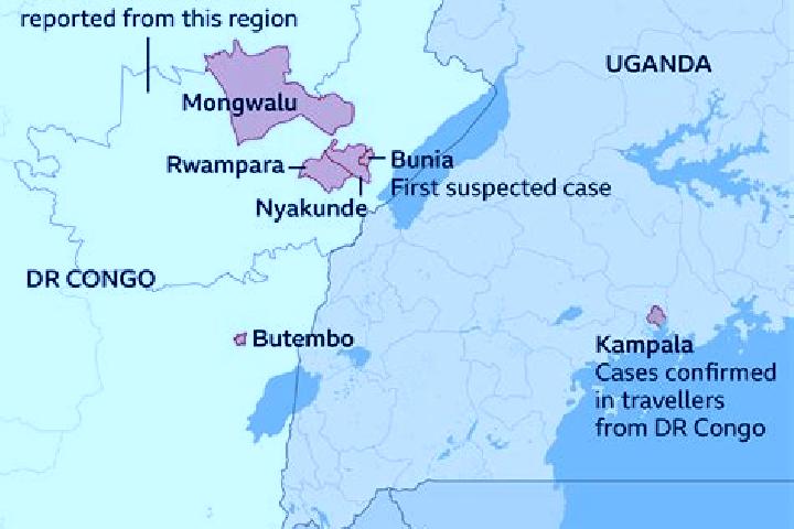Escorts Bunia, DR Congo — Local Companions