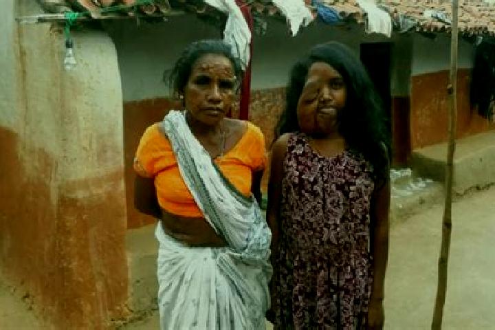 Escorts Jadugora, India — Local Companions