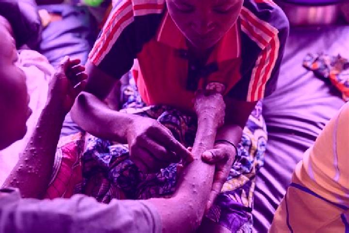 Escorts Kabare, DR Congo — Local Companions
