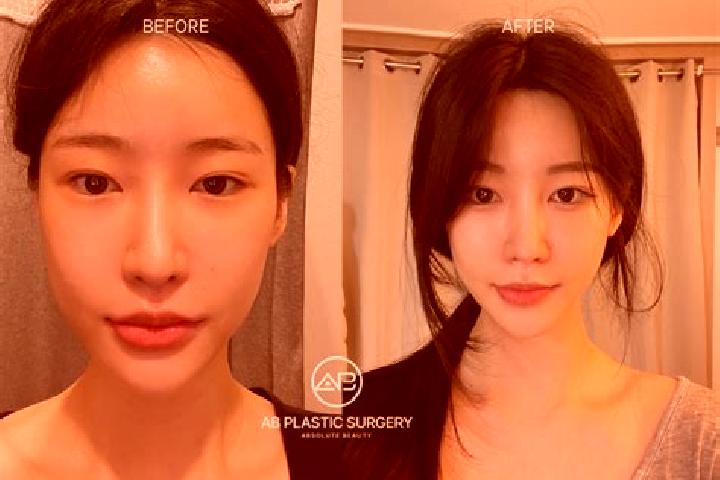 Grace, 38 — Escort in Kowon-up, North Korea