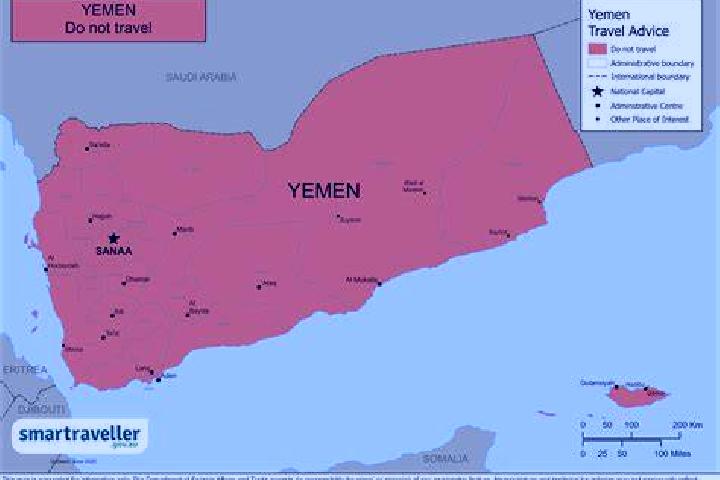 Iris, 30 — Escort in Washhah, Yemen