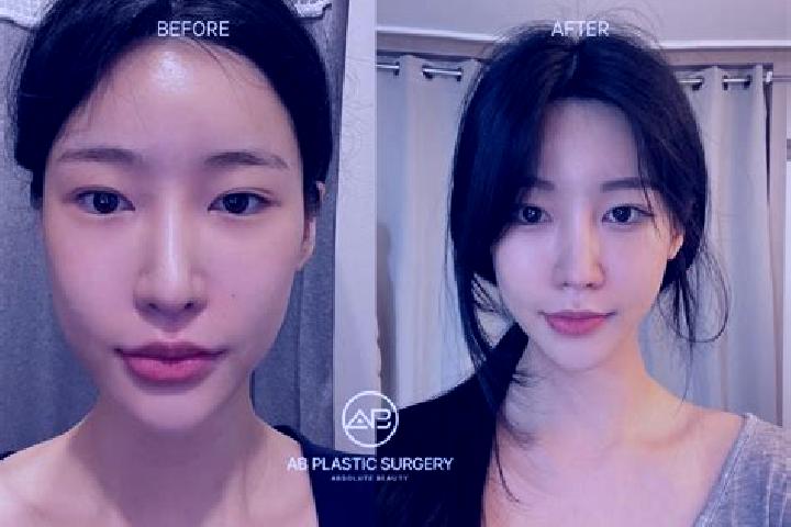 Jade, 22 — Escort in Kowon-up, North Korea