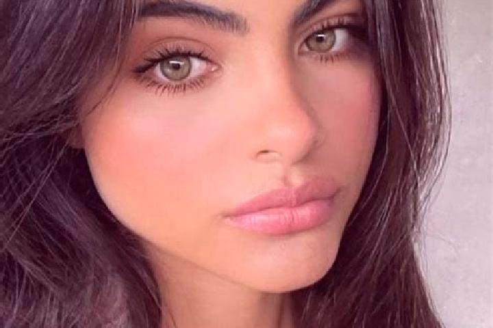 Madison, 20, a black hazel-eyed european companion based in Downside. Offering OWO, GFE, 69, Roleplay. Available for incall and outcall, overnight bookings a...