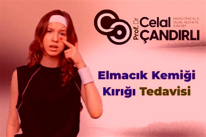 Maya, 35 — Escort in Elmacik, Turkey