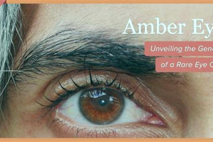 Rose, 29, a red amber-eyed mixed companion based in Ovada. Offering Dinner Date, OWO, Overnight. Available for incall and outcall, overnight bookings available.