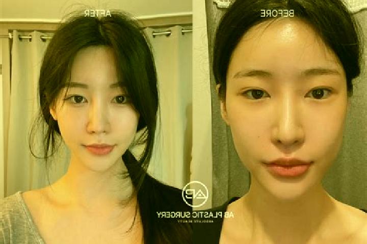 Violet, 24 — Escort in Kowon-up, North Korea