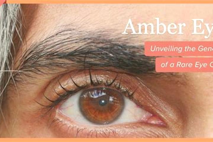 Zoe, 20, a red amber-eyed mixed companion based in Loacan. Offering Striptease, 69, Duos. Available for incall and outcall, day and evening dates.